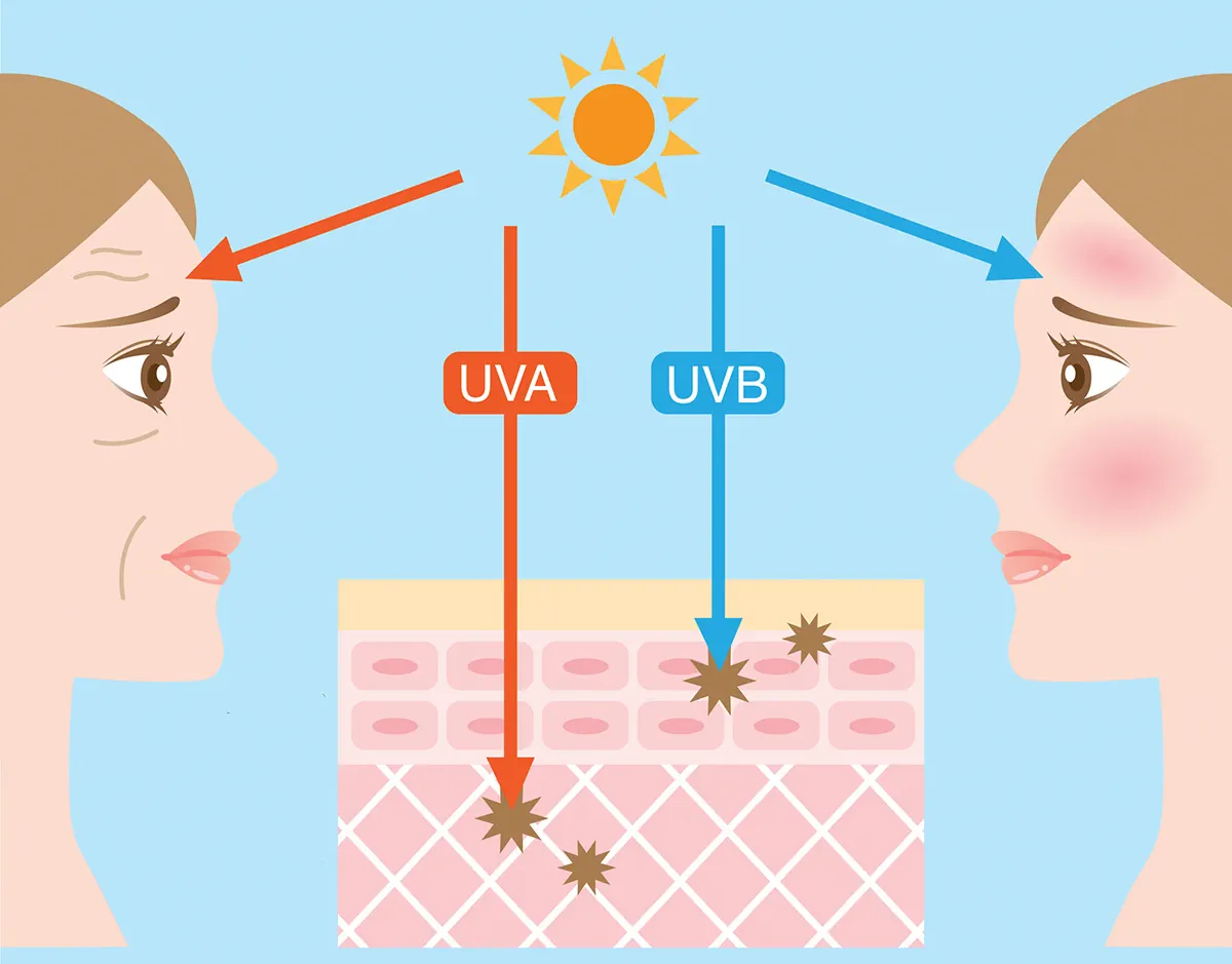 Tuyệt chiêu chọn kem chống nắng phù hợp giúp bảo vệ da khỏi tác hại của tia UV